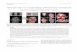 Makeup Lamps: Live Augmentation of Human Faces via Projection · captured projected textures on the surface [ZSW13,RKK14], printed visual markers [AIS15], or using the information