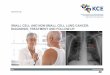 Non-Small Cell and Small Cell Lung Cancer: Diagnosis ... · 2013 kce report 206 good clinical practice small cell and non-small cell lung cancer: diagnosis, treatment and follow-up