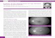 Updates in the Management of Age-Related …Updates in the Management of Age-Related Macular Degeneration Dr. Timothy YY Lai Introduction Age-related macular degeneration (AMD) is