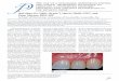 The use of a scannable impression coping and digital ... · 190 Volume 109 Issue 3 The Journal of Prosthetic Dentistry Lin et al 6 Milled polyurethane definitive restoration adjusted