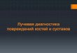 Лучевая диагностика повреждений костей и суставовdo.rsmu.ru/fileadmin/user_upload/mbf/kosti_3__travmy_.pdf · Повреждения костей