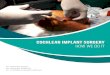 COCHLEAR IMPLANT SURGERY - Pratidhwani A Cochlear Implant (CI) is a surgically implantable device to