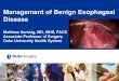 Management of Benign Esophageal Disease€¦ · DeVault KR, Castell DO. Guidelines for the diagnosis and treatment of gastroesophageal reflux disease. Practice Parameters Committee