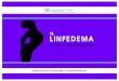 LINFEDEMA - AUSL.RE.IT · Il linfedema è una patologia cronica che può comparire precocemente dopo l’intervento o anche dopo molto tempo. Questi i sintomi più frequenti: •