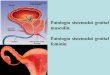 Patologia sistemului genital masculin. Patologia ... · PDF file Tema: Patologia sistemului genital masculin. Patologia sistemului genital feminine. I. Microprepatate : №227. Adenocarcinom