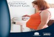 Characteristics of GESTATIONAL WEIGHT GAINFig. 2 Recommended weight gain by pre-pregnancy BMI Adequate Inadequate Excessive Over 50% of Iowa Medicaid mothers in 2011 were either overweight