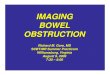 IMAGING BOWEL OBSTRUCTION R… · BOWEL OBSTRUCTION • Change in bowel caliber • Dilated SB (>2.5 cm)- colon (> 6 cm) proximal to transition point • Normal or diminished caliber