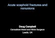 Acute scaphoid fractures and nonunions 2013/Acute scapho… · Acute scaphoid fractures and nonunions Doug Campbell Consultant Hand and Wrist Surgeon Leeds, UK . Mechanism Fall onto