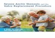 Severe Aortic Stenosis Valve Replacement Procedure...Severe aortic stenosis is an age-related, progressive disease. It can be caused by a congenital heart defect, rheumatic fever,