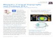 Ike Ahmed, MD University of Toronto Biometry, …...Biometry, Corneal Topography and Premium IOLs Combining Corneal Topography with Optical Biometry hen it comes to modern-day IOL
