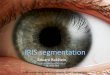 IRIS recognition II.cw.fel.cvut.cz/wiki/_media/courses/a6m33bio/iris_2-4-2016.pdf · approximated by (non-concentric) circles (problem: off-axis gaze and specific cases) Daugman's
