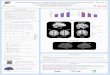 Multimodal approach: Grey matter differences in Early and Late … · 2011. 9. 23. · thickness (CT) analyses to investigate possible grey matter differences between early and late-trained