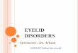 EYELID DISORDERS - كلية الطب · 2019. 7. 5. · The eyelid is consist of four layers: 1- An anterior layer of skin and subcutaneous tissue. 2- Muscular layer that comprises
