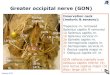 Greater occipital nerve (GON) lataster deel 5 b.pdf · N. occipitalis major N. occipitalis tertius Nn. supra- claviculares Maastricht University ANATOMY / EMBRYOLOGY FACULTY OF HEALTH,