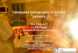 Computed tomography in trauma patients Computed tomography in trauma patients Why Trauma CT CT techniques