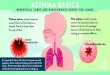 ASTHMA BASICS - Abbott Laboratories · ASTHMA BASICS BRONCHIAL TUBES ARE PASSAGEWAYS INSIDE THE LUNGS It’s important for those with asthma to not just cope with symptoms, but to