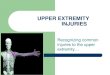 UPPER EXTREMITY INJURIES - boliveira.weebly.comboliveira.weebly.com/uploads/8/3/3/2/8332701/upper_extremity-1_1.… · UPPER EXTREMITY INJURIES Recognizing common injuries to the