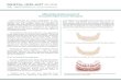 A ordable Replacement of Uncomfortable Lower Dentures...Uncomfortable Lower Dentures There are a number of options for replacement of uncomfortable lower dentures. The two most a"ordable