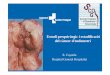 Estudi prequirúrgic i estadificació del càncer d'endometri · Dilation and curettage fails to detect most focal lesions in the uterine cavity in women with postmenopausal bleeding