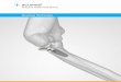 Anatomic Radial Head System - Acumed · methods and approaches that improve patient care. ... the patient’s anatomy. The dish depth remains static at 2 mm amongst all implant diameters,