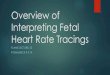 Overview of Interpreting Fetal Heart Rate Tracings · 2019. 4. 24. · Internal vs. External Monitoring u Fetal heart rate u External monitor: Doppler ultrasound u Internal monitor: