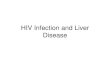 HIV Infection and Liver Disease Song - HIV... · ~ mild xaminitis, fever, malaise, LOW, hepar • Fungal infection – cryptococcus, histoplasmosis, candida, aspergillus • PJP in