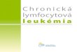Chronická lymfocytová leukémiavou.sk/wp-content/uploads/2014/02/chronicka-lymfocytova... · 2014. 2. 10. · Chronická lymfocytová leukémia (CLL) Autor: Lymfómová skupina