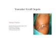 Graft Sepsis in Vascular Surgery - University of Pretoria · sepsis • Unexplained sepsis • Abdominal distension • Prolonged ileus • Overlying cellulitis • Limb swelling