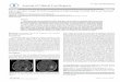 l i n i c al Fischer et al, Clin Case Rep 21, :4 o f sC ¢ a R a l ...€¦ · Intravascular Large B-Cell Lymphoma Mimicking Central Nervous System Vasculitis Fischer M#1,2, Iglseder