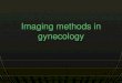 Imaging methods in gynecology - radiologieplzen.eu · Actinomycosis. Endometriosis T1 w.i. T2 w.i. Fat supression. Uterine tumors Leiomyoma . Cervical carcinoma. Peritubal adhesions