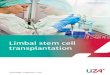 Limbal stem cell transplantation - UZA · stem cell transplantation in our centre. This leaﬂ et complements the explanation you received from your ophthalmologist and nursing staﬀ