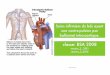New classe: BSA 2008ferronfred.eu/onewebmedia/Intra aortic ballon... · 2017. 2. 16. · • Il s’agit d’un dispositif mécanique intra- ... ( en raison de la majoration du risque