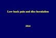 Low back pain and disc herniation - neurology.dote.huneurology.dote.hu/2018-2019/TOKkuld.FK.pdfTreatment Acute pain (