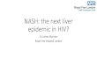 NASH: the next liver epidemic in HIV?...2019/06/11  · NAFL n=2 Normal n=1 ≥F2 Fibrosis n=5 ≥ F2 Fibrosis n=7 ≥ F3 Fibrosis n=1 ≥ F3 Fibrosis n=6 Liver biopsy n=15 NASH n=12