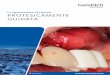 La rigenerazione dei tessuti protesicamente guidata · 7 Chiapasco M & Casentini P. Implant supported dental restorations in compromised edentulous sites: optimization of results