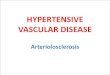 HYPERTENSIVE VASCULAR DISEASE - JU Medicine...2018/01/05  · HYPERTENSIVE VASCULAR DISEASE Arteriolosclerosis Hypertension(HTN) • Cutoffs in diagnosing hypertension in clinical