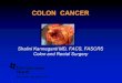 Shalini Kanneganti MD, FACS, FASCRS Colon and Rectal Surgery · 2017. 11. 22. · Colon cancer n SECOND most common cause of cancer deaths in US n 107,000 new patient each year n