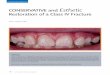 American Academy of Cosmetic Dentistry ......Journal of Cosmetic Dentistry 17The creation of a smooth, harmonious guidance pattern, both in protrusive and lateral excursions, is crucial