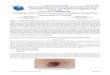Enhanced Skin Cancer Detection Techniques Using Otsu ...ijarcsse.com/Before_August_2017/docs/papers/Volume_5/5...Enhanced Skin Cancer Detection Techniques Using Otsu ... ... [5]