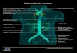 Normal Aortic Anatomy - University of MichiganRight subclavian artery Innominate artery Right common carotid artery Descending aorta (thoracic portion) Aorta (abdominal portion) Inferior