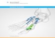 Forefoot/Midfoot Plating System - Acumed · 2017. 8. 29. · By designing the Forefoot/Midfoot Plating System on the same platform as other Acumed foot and ankle systems, such as