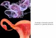 Patologia sistemului genital feminin și a glandei mamare