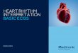 HEART RHYTHM INTERPRETATION BASIC ECGS