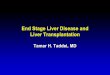 End Stage Liver Disease and Liver Transplantation