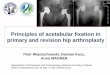 Principles of acetabular fixation in primary and revision 