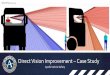 Direct Vision Improvement Case Study - UNECE