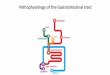 Pathophysiology of the Gastrointestinal tract