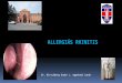 Az allergiás Rhinitis kezelési algoritmusa