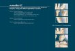 Comprehensive Solutions for Forefoot and Midfoot Surgery 