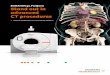 SOMATOM go.Platform Stand out in advanced CT procedures